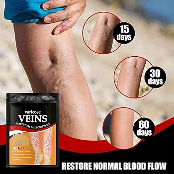 Parches Para Reducir Varices